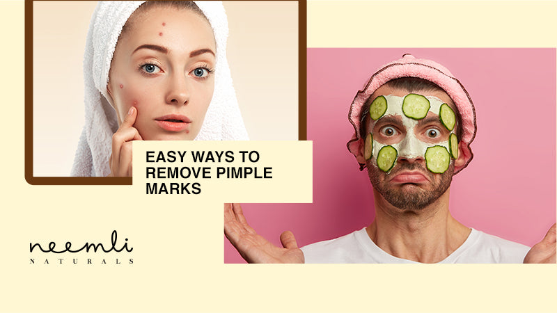 How To Remove Pimple Marks In Easy Ways?
