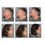 Arcolys and Biotin Grey Reverse Concentrate